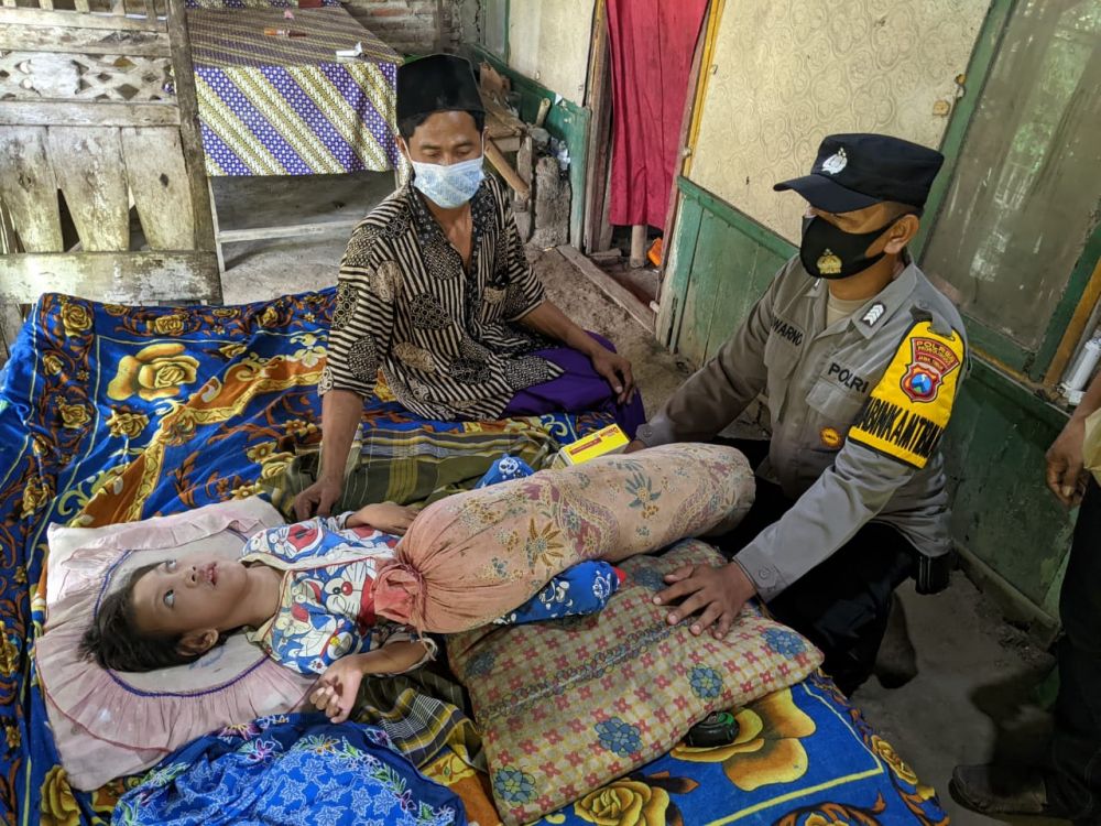 Polsek Besuk peduli penderita gizi buruk